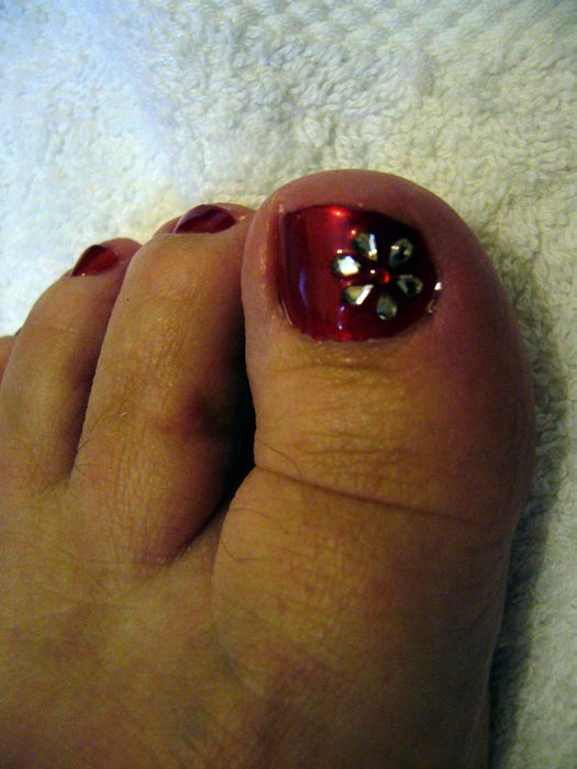 please click for next toe zone gallery image